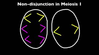 33 Nondisjunction and Down Syndrome [upl. by Whitson]