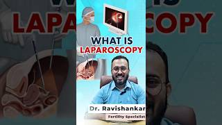 Laparoscopy എന്തിന് ചെയ്യുന്നതാണ് ഗുണങ്ങൾ എന്താണ് [upl. by Okomom]