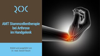 AMT Stammzellentherapie bei Arthrose im Handgelenk  ROC Aschheim [upl. by Vasta]