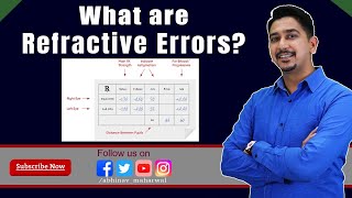 What are Refractive Errors I Glasses power  Eyepower I Myopia Hyperopia Astigmatism amp Presbyopia [upl. by Ardnael457]