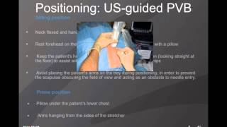 Webinar UltrasoundGuided Paravertebral Nerve Blocks [upl. by Weikert]