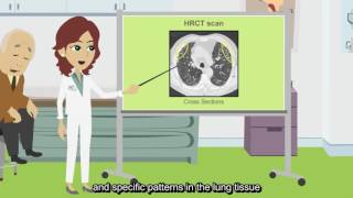 What is an HRCT scan [upl. by Tannen]