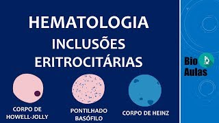 Inclusões nos Eritrócitos  Hematologia [upl. by Ahsitnauq533]