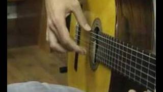 1Flamenco guitarist and focal hand dystonia Distonía focal [upl. by Xymenes629]