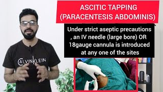 Ascitic Tapping OR Paracentesis Abdominis  Procedure  DRY TAP  Indication  Complication [upl. by Annora]