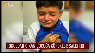 Okuldan çıkan çocuğa köpekler saldırdı [upl. by Lockwood]