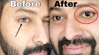 Wearing Color Lens Gone Wrong 😱 First Time Color Lens Must watch before Using  Shadhik Azeez [upl. by Marie-Jeanne]