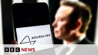 Elon Musk announces first Neuralink wireless brain chip implant in a human  BBC News [upl. by Zebulen]