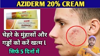 Aziderm 20 cream use dose benefits and side effects full review in hindi [upl. by Nevaed]