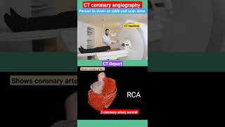 CT coronary angiography l heart coronaryartery shorts [upl. by Way]