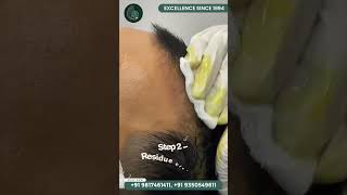 PRP Sessions after Hair Transplant  PRP for Hair Growth  Dr Sameer Pundeer  Mahendra Hair amp Skin [upl. by Politi]