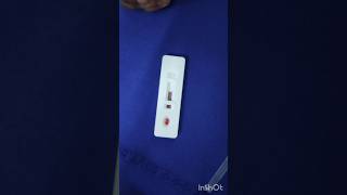 Malaria test in emergency ward emergency duty hospital nursing doctor subscribe mbbs [upl. by Bogey790]