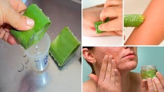 10 Uses Of Aloe Vera Gel  Aloe Vera Benefits for Skin amp Hair  Wokali Aloe Vera Soothing Gel [upl. by Akeim]