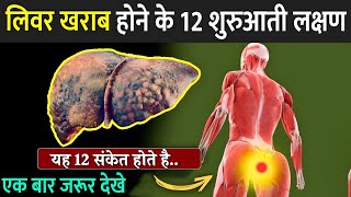 लिवर खराब होने में 12 शुरुआती लक्षण  12 Weird Signs Of Liver Damage  Liver Damage Signs In Hindi [upl. by Val]