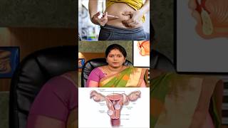 Fibroid கட்டி வர முக்கிய காரணம் இதுதான் 😳 [upl. by Eelesor]