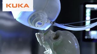 KUKA Medical Robotics  The Future of Medicine [upl. by Shirline]