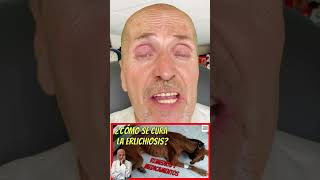 ERLICHIOISIS CANINA 🆘 QUE ES SÍNTOMAS FASES TERMINAL CRÓNICA DIAGNOSTICO Y TRATAMIENTO CASER [upl. by Goulette261]