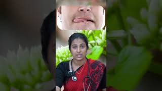 Epilepsy  வலிப்பு நோய்  Fits  Tamil shorts trending [upl. by Liauqram152]