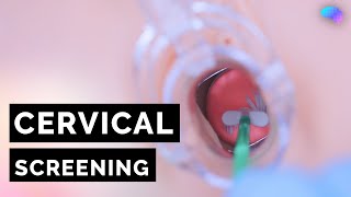 Cervical Screening Smear  HPV  OSCE Guide  UKMLA  CPSA [upl. by Lotson]