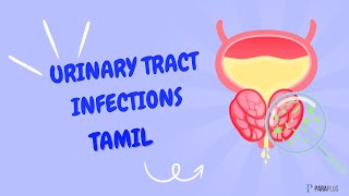 Urinary Tract Infection UTI in Tamil Definition Symptoms Causes Diagnosis and Management [upl. by Kern136]