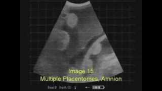 Ultrasound Pregnancy Testing 3rd Trimester Cows with ReproScan XTC [upl. by Hafital]