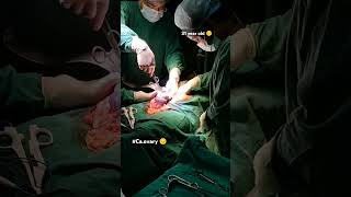 31 year old Interval debulking surgery😔🤲 caovarymedicalstudent doctor viralshort video 🙏🛐 [upl. by Akeim]