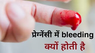 Pregnancy me blood ka aana  blood spotting during pregnancy [upl. by Zeculon]