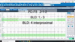 DentiAI Voice  Denticon Demo [upl. by Leay]