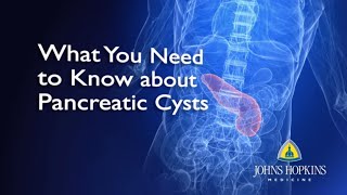 What You Need to Know About Pancreatic Cysts [upl. by Arracahs]