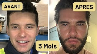 COMMENT FAIRE POUSSER SA BARBE RAPIDEMENT  MINOXIDIL BARBE [upl. by Nerreg53]