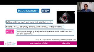 How to assess volume status by echo  Dr Hatem soliman [upl. by Rodrich26]