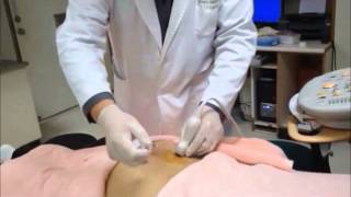 UltrasoundGuided Sacroiliac Joint Injection Technique [upl. by Vareck262]