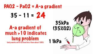 Arterial blood gas interpretation in 5 min [upl. by Yahsat678]