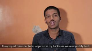 Adalimumab  Ankylosing Spondylitis  Testimonial  Mumbai [upl. by Otila]