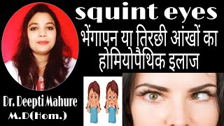 What is squint  How to cure squint  भेंगापन का होम्योपैथिक उपचार Homeopathic Treatment of Squint [upl. by Eelac]