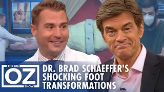 The Most Shocking Foot Transformations with Dr Brad Schaeffer  Oz Health [upl. by Anileuqcaj]