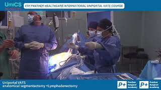 8th Panther Uniportal VATS MC live surgery Anatomical segmentocotmy  lymphadenectomy by Dr Diego [upl. by Trebleht]