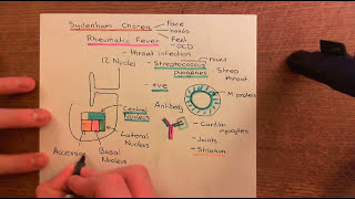 Anxiety and Anxiolytic Drugs Part 2 [upl. by Deborath]