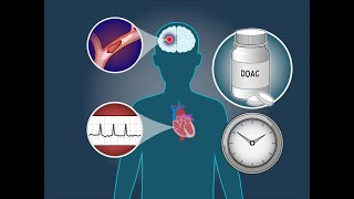 Anticoagulation Timing after Stroke in Atrial Fibrillation  NEJM [upl. by Hurleigh]