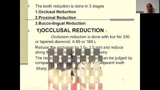 STAINLESS STEEL CROWNS  DEPARTMENT OF PEDODONTICS  Dr AMBILI AYILLIATH [upl. by Nywde]