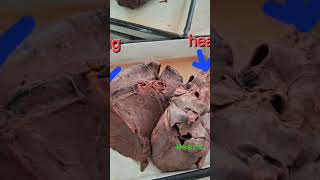 Anatomy Dissection doctor mbbs neet motivation goals doctor [upl. by Werdn]