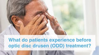 What do patients experience before optic disc drusen ODD treatment [upl. by Cirnek268]