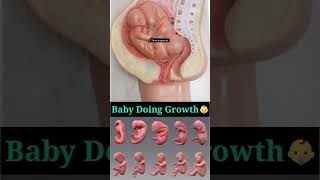 Twins baby growth [upl. by Dowell]