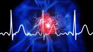 SVT AF VT VF Aritmiler EKG 2 [upl. by Cassi358]