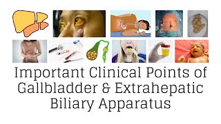 Clinical anatomy of gallbladder and extrahepatic biliary apparatus gallbladder clinicalanatomy [upl. by Terr337]