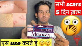 use यसे करते हे 😲  Mederma cream  Mederma advanced scar gel review  Mederma cream ke fayde scar [upl. by Yditsahc]