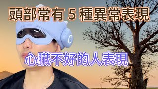 心臟好壞，頭部知曉？心臟不好之人，頭部常有 5 種異常表現 [upl. by Christiansen]