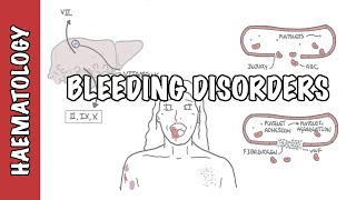 Approach to bleeding disorders  causes pathophysiology and investigations [upl. by Nyre]