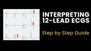 How to Interpret a 12Lead ECG A StepbyStep Guide 🫀📈 [upl. by Papst629]