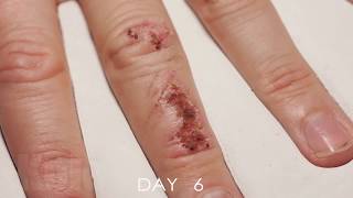 Wound Healing Time Lapse [upl. by Thurber]